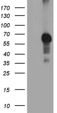 IDH1 Antibody