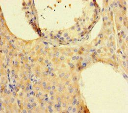ISPD Antibody
