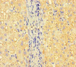 ISPD Antibody