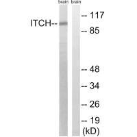 ITCH Antibody