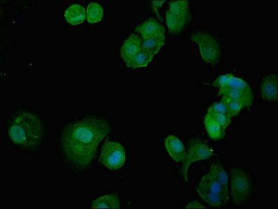 ITGA5 Antibody