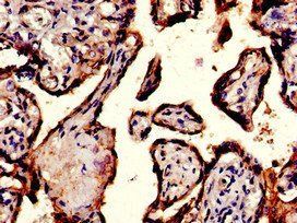 ITGA5 Antibody