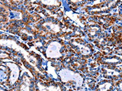 ITGA7 Antibody