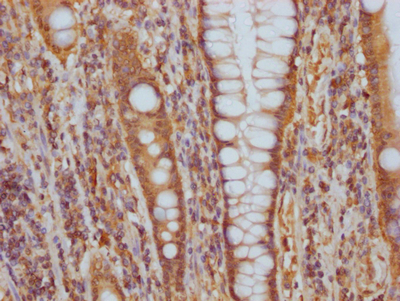 ITGAV Antibody
