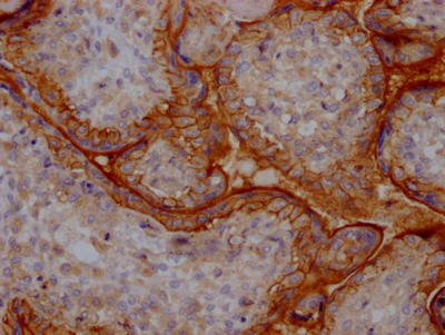 ITGAV Antibody
