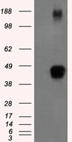 NMRK2 Antibody
