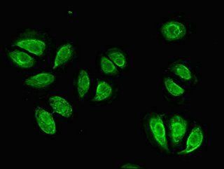 ITGB4 Antibody