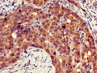 ITGB4 Antibody