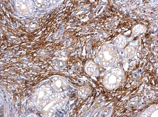 ITIH3 Rabbit Polyclonal Antibody