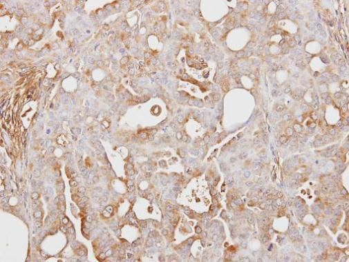 ITIH3 Rabbit Polyclonal Antibody