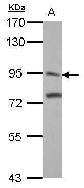 ITIH3 Rabbit Polyclonal Antibody