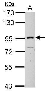 ITIH3 Rabbit Polyclonal Antibody