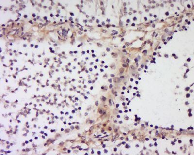 ITIH4 Rabbit Polyclonal Antibody