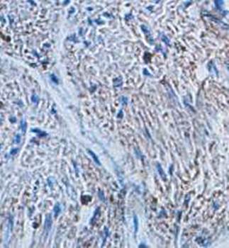 ITM2A Rabbit Polyclonal Antibody