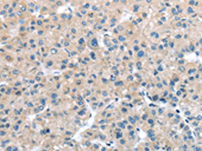 ITPA Antibody