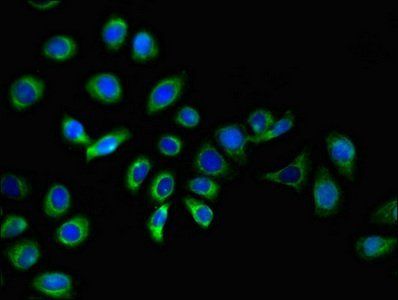 IZUMO1 Antibody