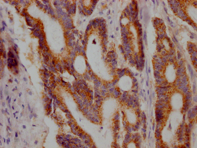 JAK1 Antibody