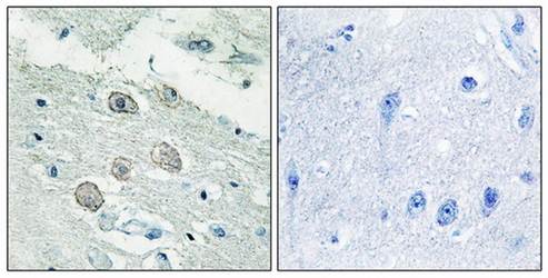 JAK1 Antibody