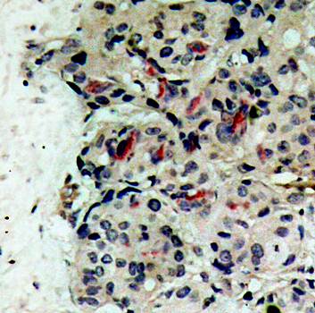 JAK1 (Ab022) Antibody