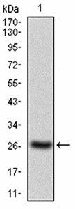 JAK2 Antibody