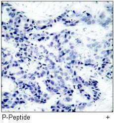 JAK2 (Phospho-Tyr1007) Antibody