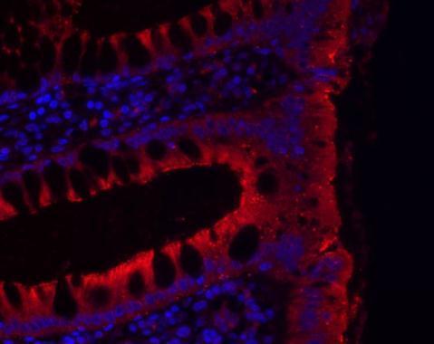 JAM-B Rabbit Polyclonal Antibody
