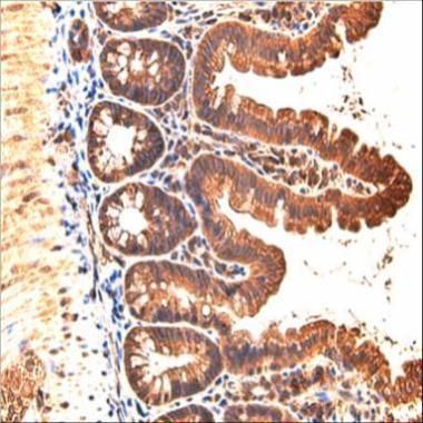 JAM-B Rabbit Polyclonal Antibody
