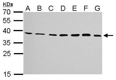 JAM-B Rabbit Polyclonal Antibody