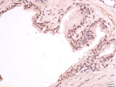 Jarid1C Rabbit Polyclonal Antibody