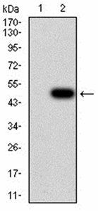 JARID2 Antibody