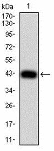 JARID2 Antibody