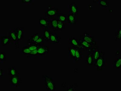 JARID2 Antibody