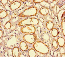 JARID2 Antibody