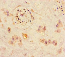 JARID2 Antibody