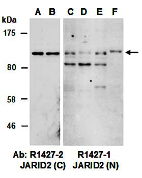 JARID2 (N) Antibody, Rabbit Polyclonal