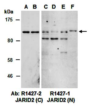 JARID2 (C) Antibody, Rabbit Polyclonal