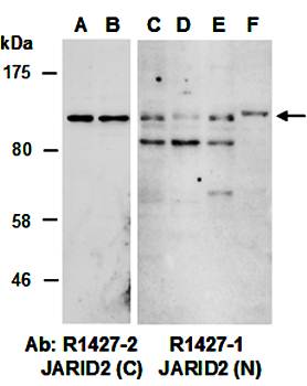 JARID2 (vPairTM) Antibodies