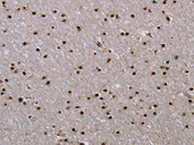 JMJD6 Antibody