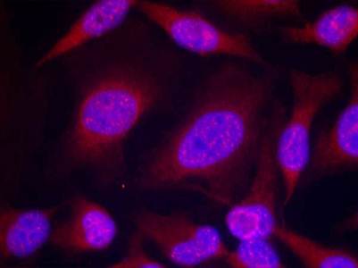 JNK1/JNK2/JNK3 (phospho-Thr183/Tyr185) Antibody