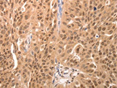 JUND Antibody