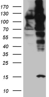 Karyopherin beta 3 Antibody