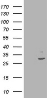 KATNAL1 Antibody