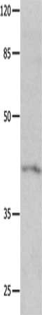 KCNA5 Antibody