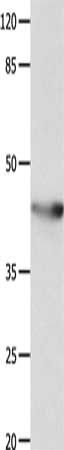KCNA5 Antibody
