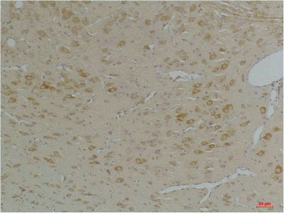 KCNIP3 Antibody