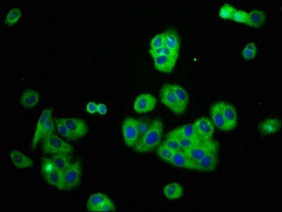 KCNJ8 Antibody