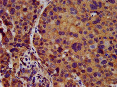 KCNJ8 Antibody