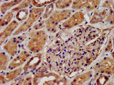 KCNJ8 Antibody