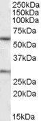 KCNQ1 Antibody