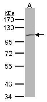 heat shock protein family A (Hsp70) member 6 Antibody